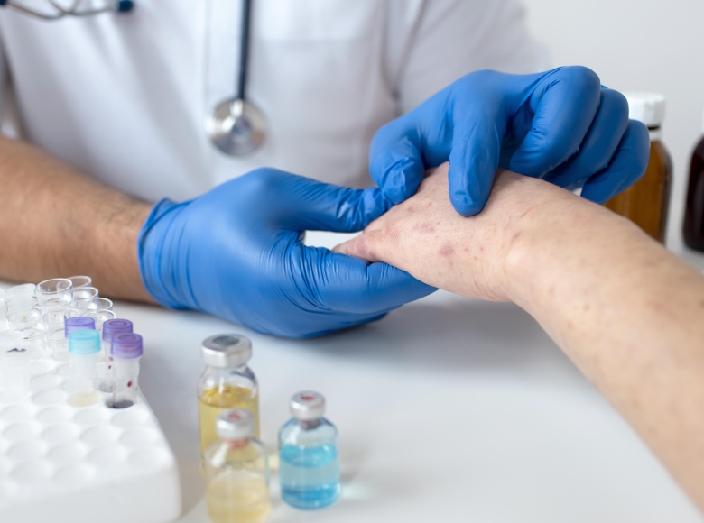 allergy care at chennai